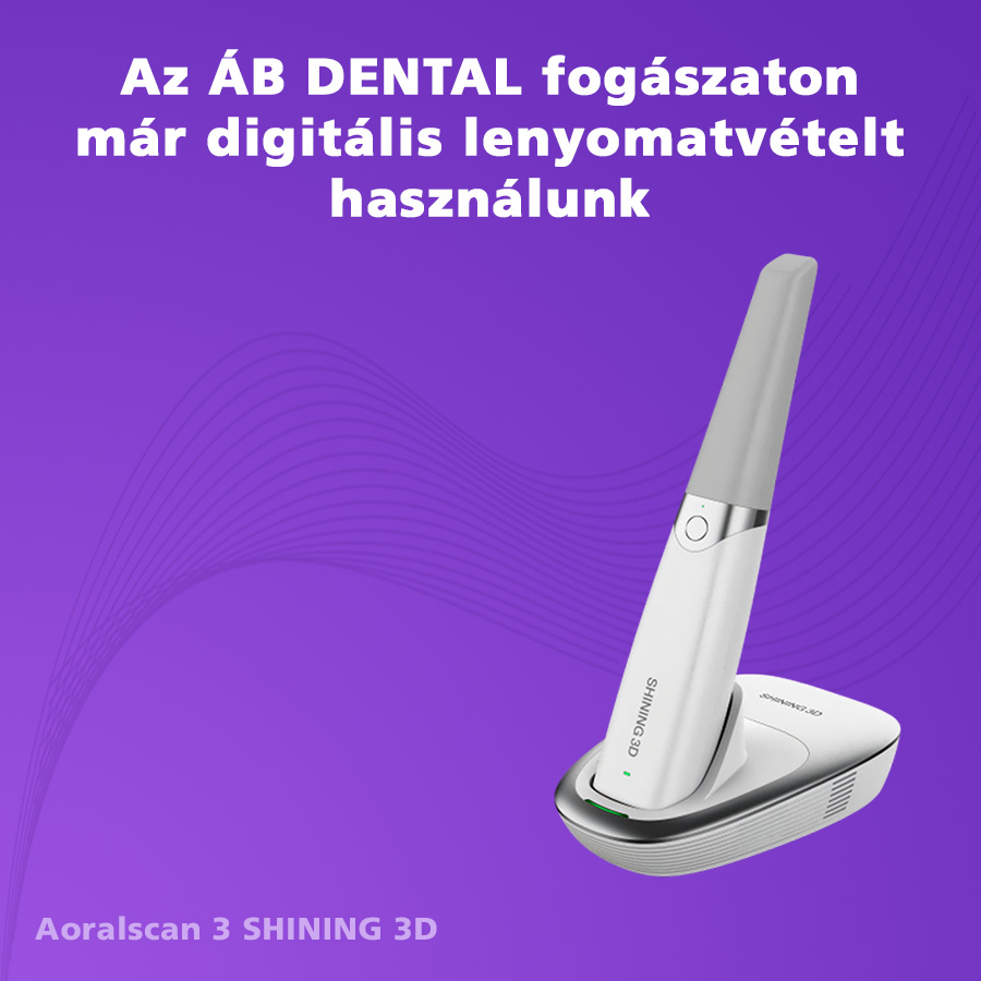 Digitális lenyomatvétel